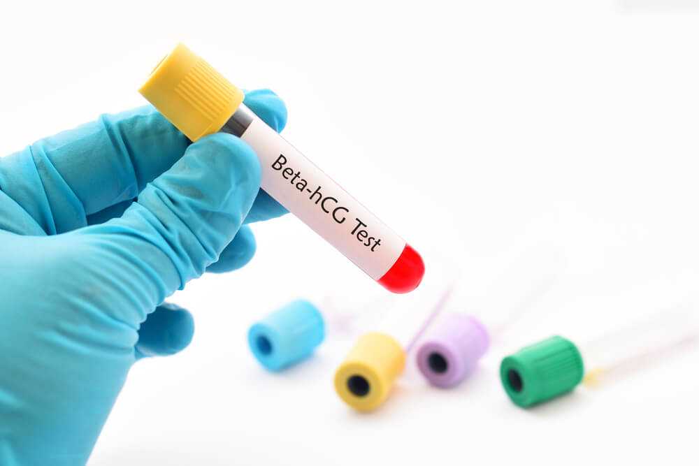 beta hcg testi ne zaman yapılır