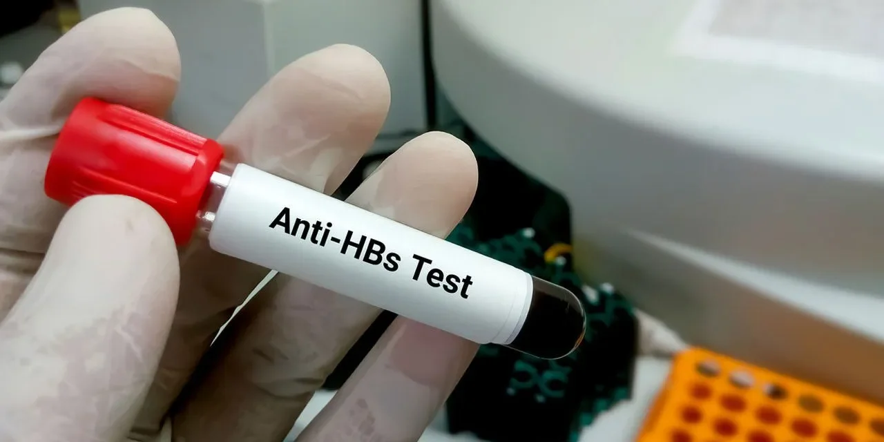 Anti-HBs